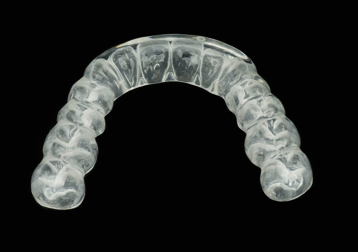 Do Invisalign Braces Work in Cleveland OH Area