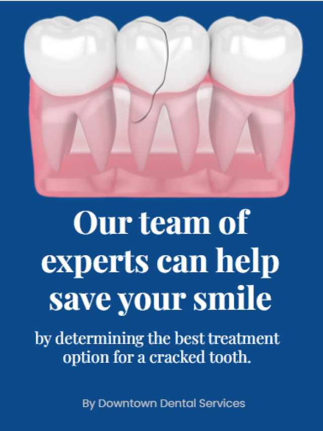 Our team of experts can help save your smile