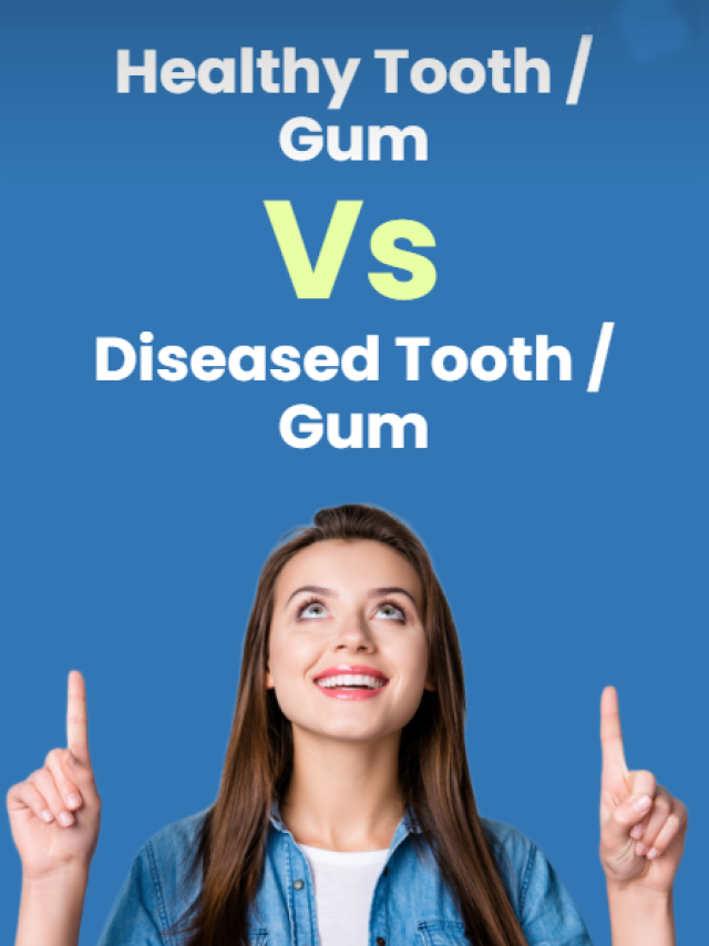 Healthy Tooth / Gum